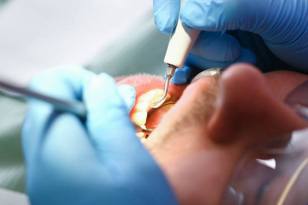 Best Emergency Broken Tooth Repair in Fuller Heights, FL