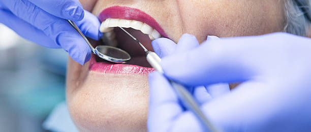 Best Emergency Tooth Extraction in Fuller Heights, FL